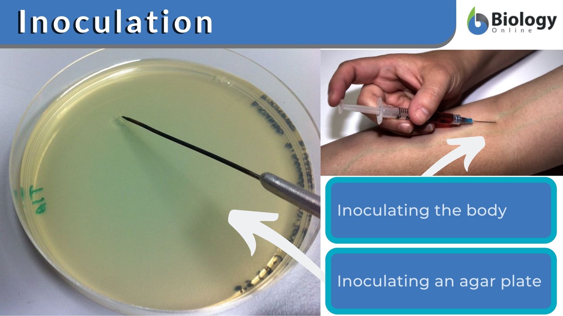 What Does Inoculate Mean? A Complete Definition and Usage Guide