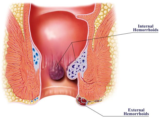 Is Back Door Intercourse Safe? Risks and Precautions