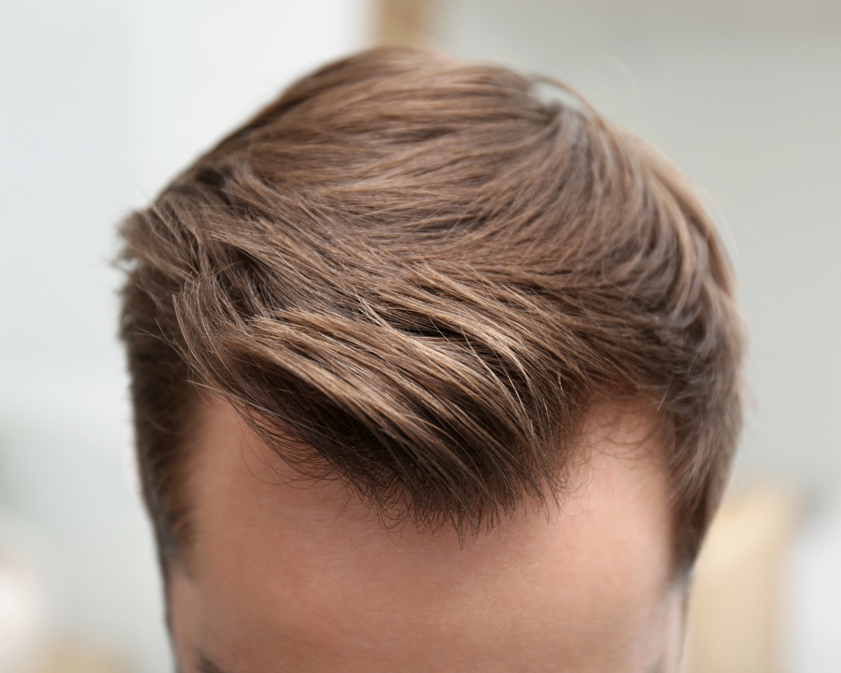 Hairstyles for Men with Receding Hairlines: Easy Haircuts to Try Today!