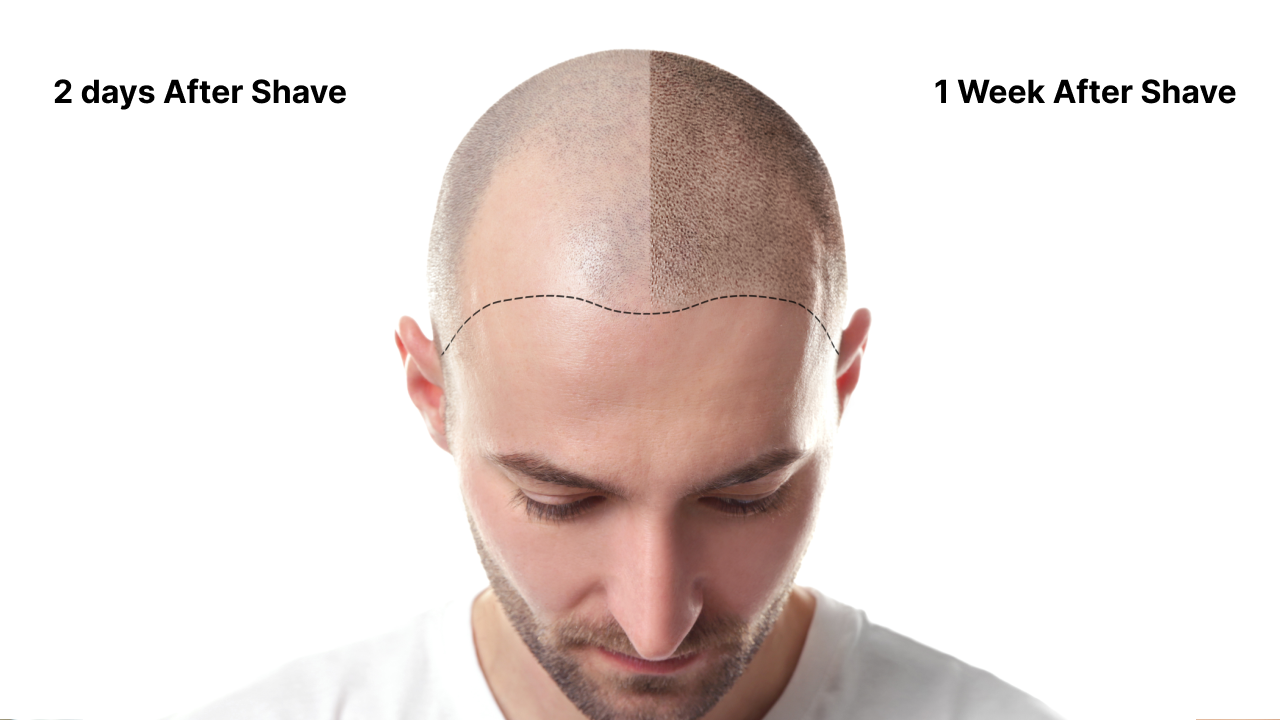 How Often Shave Head Is Right for You? Simple Guide for Bald Look!