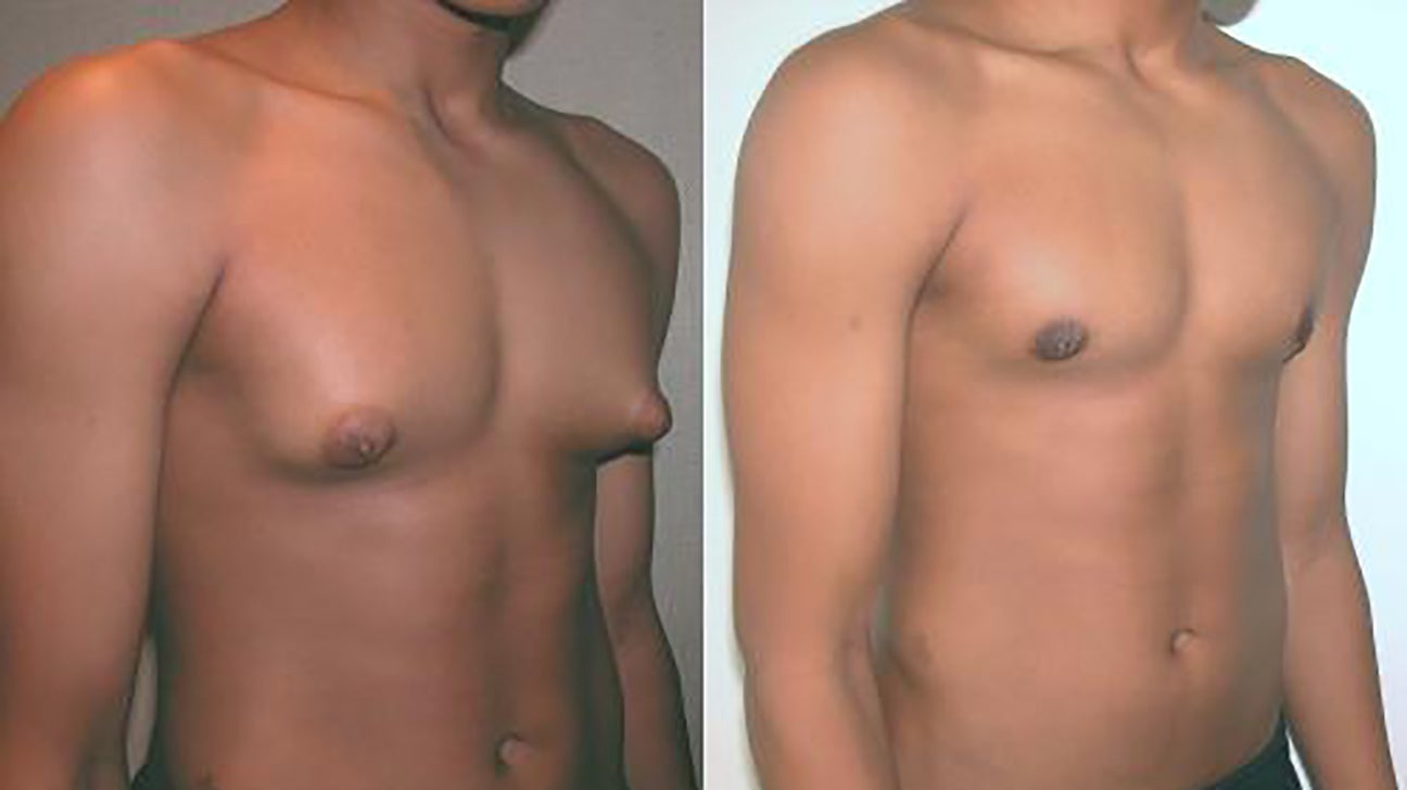 Nipple Types Male: Everything You Need to Know,Explained